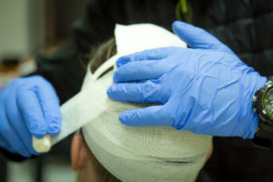 head injury lawyers in CA